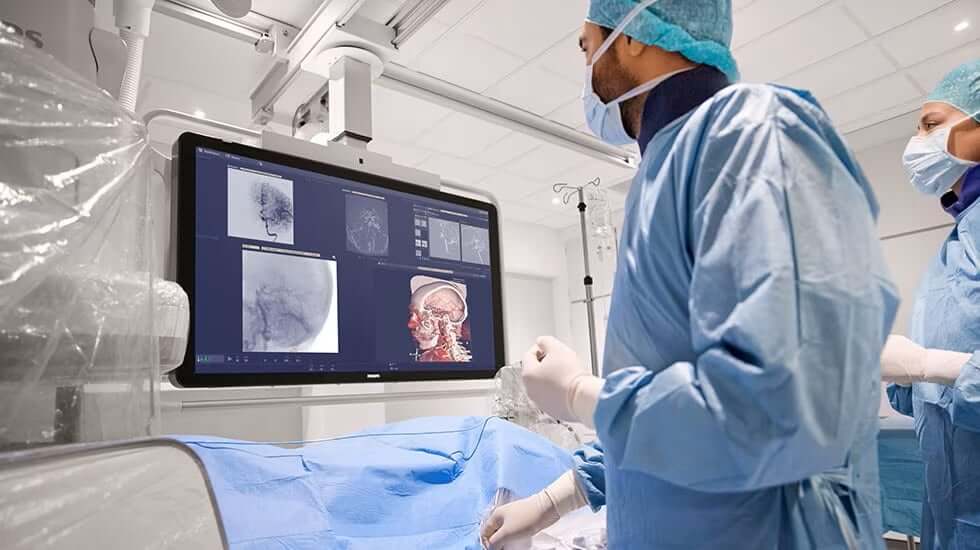 Philips brevetti AI